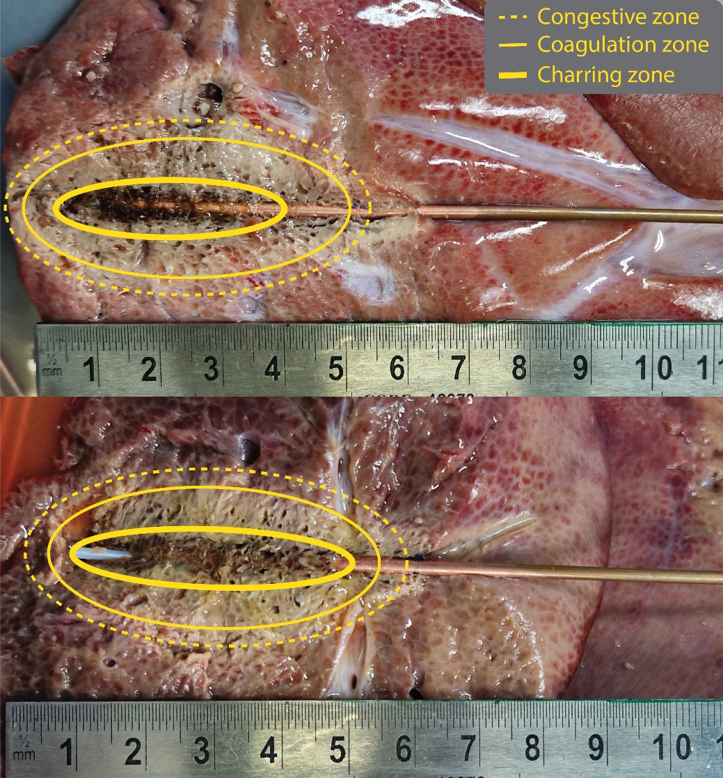 Applicator antenna and ablation zone.